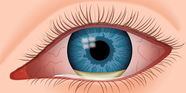 Routine Eye/ Annual Eye check ups